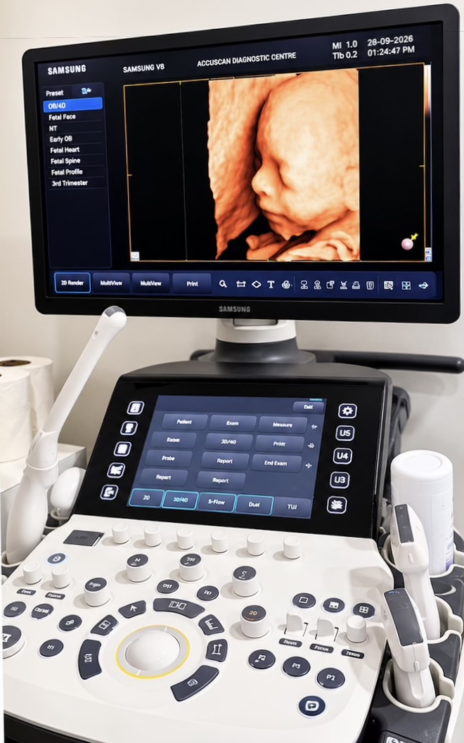 Samsung V8 ultrasound console at Accuscan