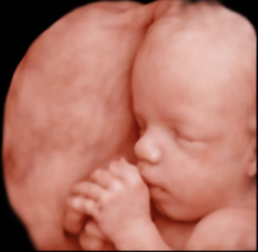 Fetal 3D ultrasound image 1