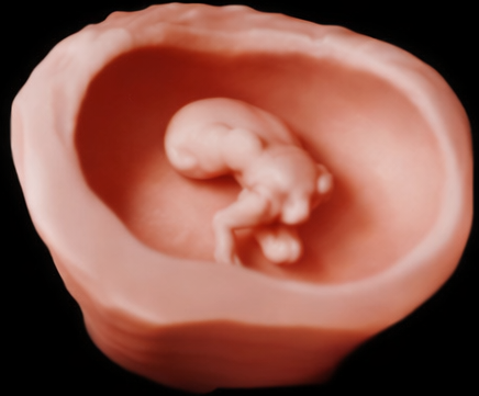 Early embryo 3D ultrasound image