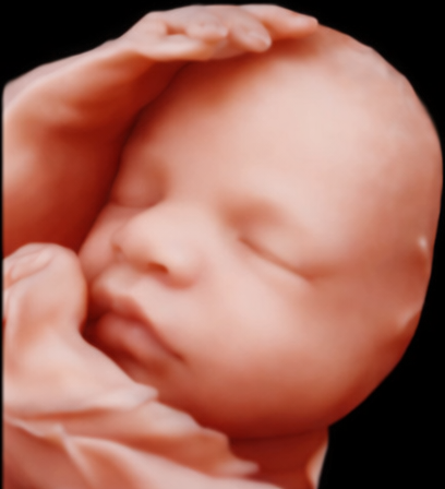 Fetal 3D face ultrasound image