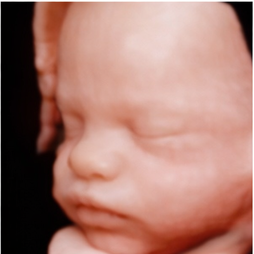 Fetal face 3D ultrasound image
