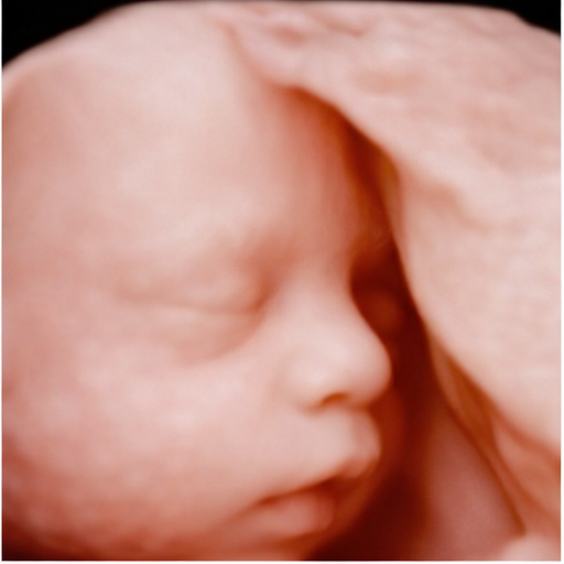 Fetal 3D ultrasound image
